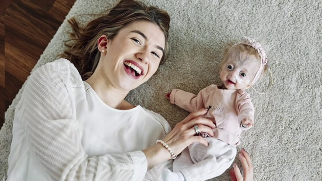 VIDEO: Conoce la historia de amor Eline Leonie, la niña que peleó con una sonrisa contra la Progeria – Periódico Zócalo | Noticias de Saltillo, Piedras Negras, Monclova, Acuña - Vimarsana News