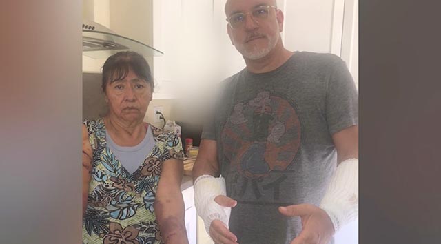 Pitbull intenta comerse a una anciana y hombre la salva; 'héroe' perdió movilidad en los brazos