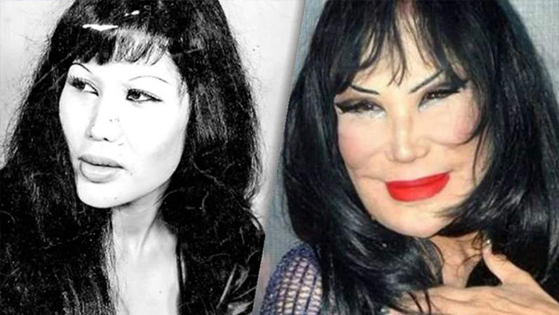 Ésta fue la cirugía estética que arruinó el rostro de Lyn May – Periódico Zócalo | Noticias de Saltillo, Piedras Negras, Monclova, Acuña - Vimarsana News